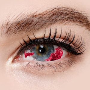 Sclera Bloodshot 22 mm